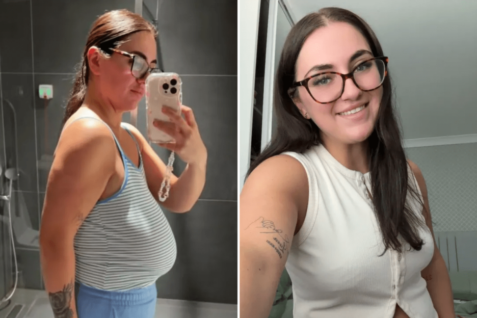 I spent £3.6k on Turkey op to drop 11 bra sizes – I was sick of men ogling my massive 36K boobs