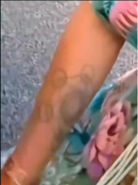 Close-up of a tattoo on an arm that appears to be glasses and a mustache.