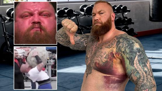 Sickest weightlifting injuries including snap ‘like gun going off’ that crowd could hear as World’s Strongest Man begins