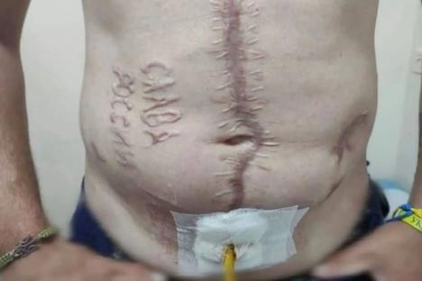 Ukrainian soldier released in prisoner swap left with ‘Glory to Russia’ burned on his body by Putin’s sick torturers