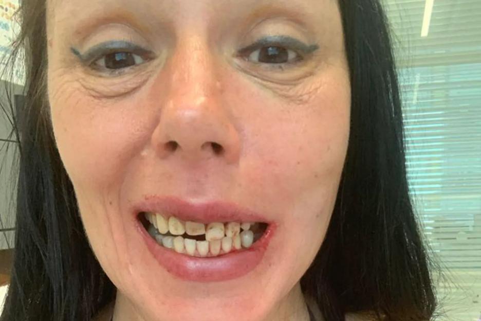 I paid £12K for new teeth after thug-ex beat me when I caught him online dating- he’d seen 35 OTHER women behind my back
