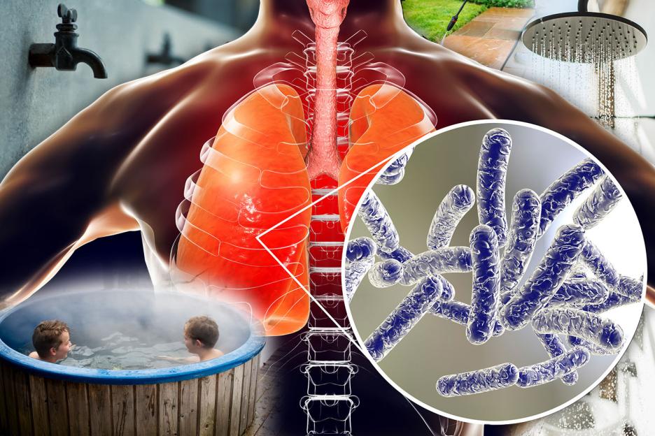 Urgent warning over fatal lung disease spread through contaminated water in taps, showers, hosepipes and hot tubs