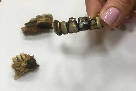 Hitler's dental remains held by a journalist.