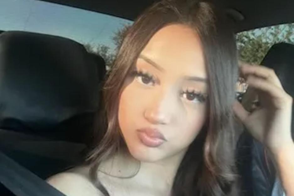 Man arrested after pack of dogs tore flesh from girl’s ‘entire body’ leaving her unrecognizable & needing 500 stitches