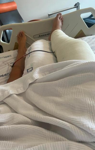 Woman's leg in a cast in a hospital bed.
