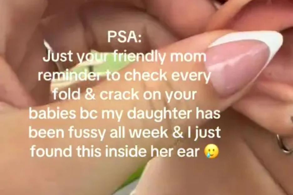Mum issues warning for parents to check ‘every fold on your kids’  – as she’s urged to take her tot to the doctors