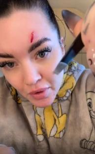 Woman with a small wound on her forehead.