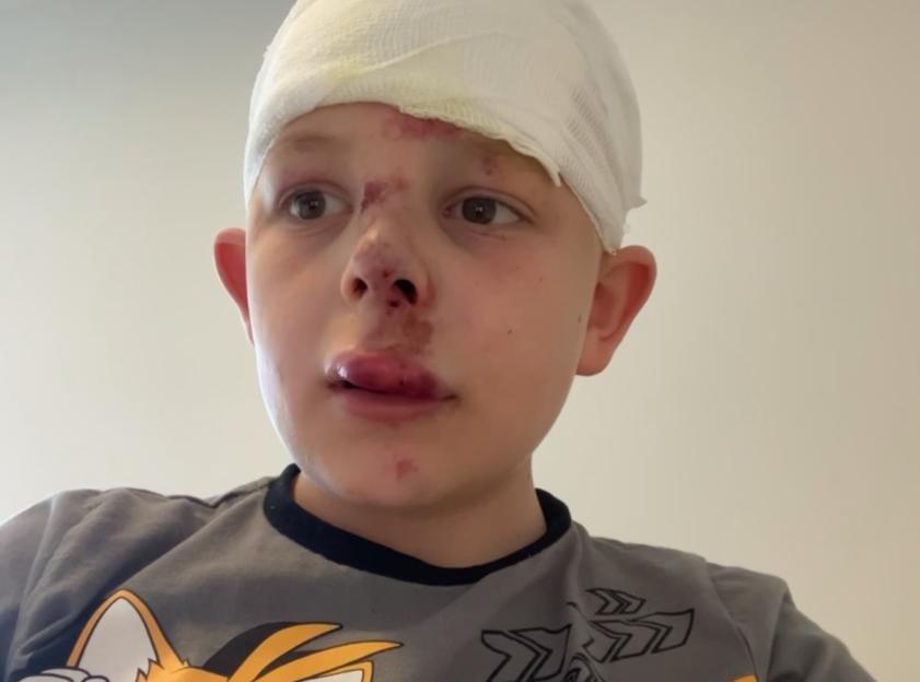 Boy with head wound and facial injuries.