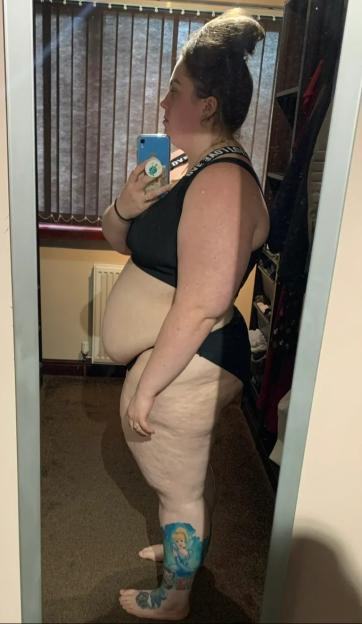Woman's before-and-after weight loss photo.