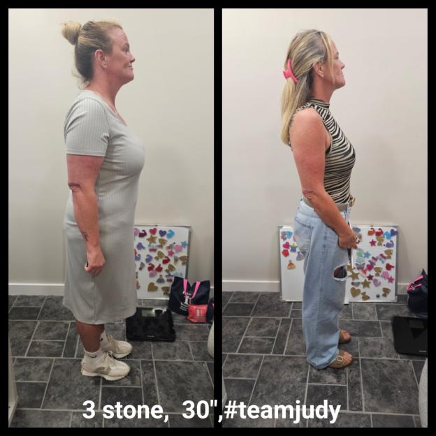 Before and after photos showing a woman's weight loss of 3 stone and 30 inches.