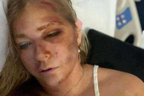 Major update in Virginia Giuffre bus crash riddle as Prince Andrew accuser leaves hospital after claiming she was dying