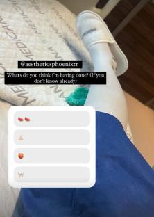 Hospital photo with poll asking what procedure is being done; options include nose job, teeth whitening, and others.