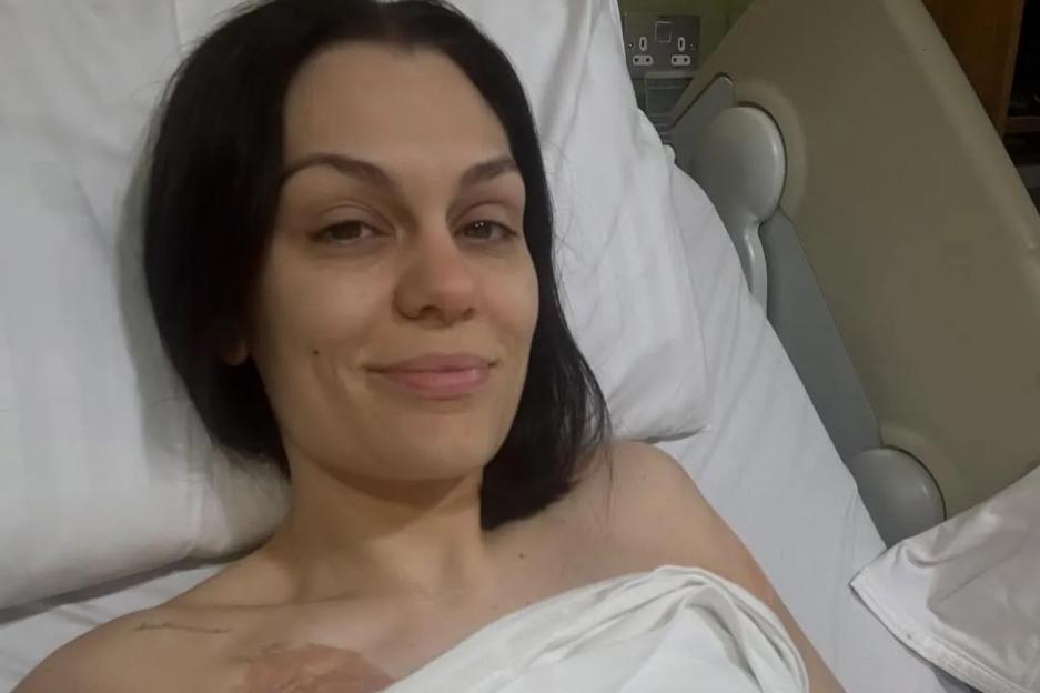 Jessie J gives health update as she reveals her hair has been ‘falling out like crazy’ during breast cancer treatment