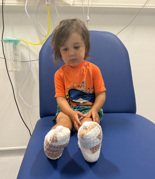 Toddler with bandaged feet sitting in a hospital chair.