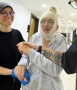 Woman with bandaged face being assisted walking in a hospital corridor.