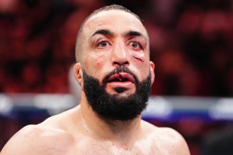 Belal Muhammad with facial injuries after a UFC welterweight bout.