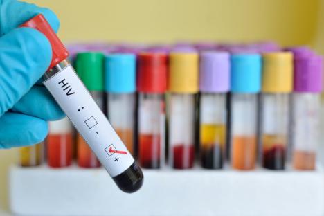 Rivers, Benue, A’Ibom top chart as Nigeria’s HIV patients hits 2 million