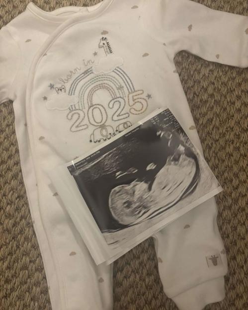 Baby's onesie with "born in 2025" and ultrasound image.