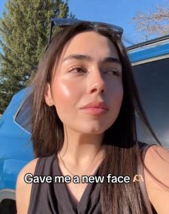 Woman's before-and-after weight loss photo.