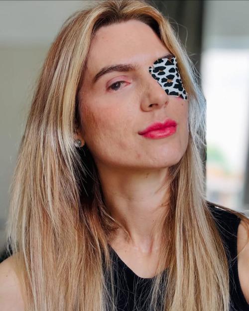 Woman with an eye patch.