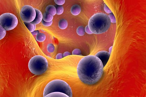 Scarlet fever is caused by bacteria known as group A streptococcus