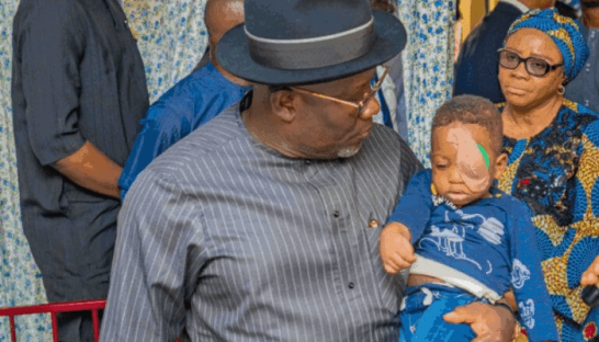 21 months after, NDLEA abandons family of 2-year-old toddler killed, as survivor risks blindness 3