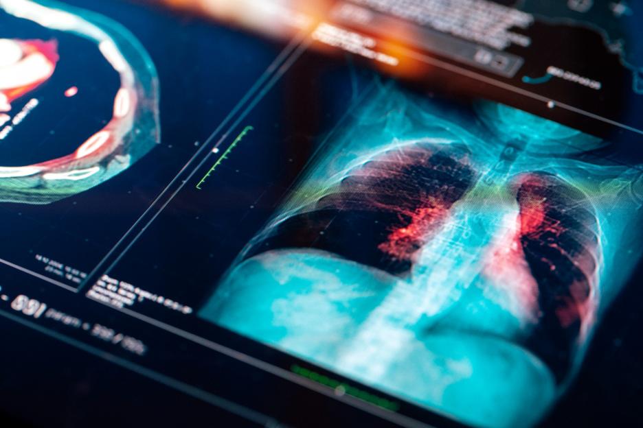 The ‘silent’ disease that causes sudden heart failure… and one in FIVE Brits have it – know the 4 signs