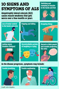 Illustration of 10 signs and symptoms of ALS.