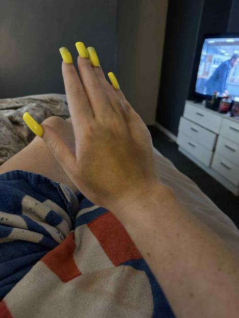 A hand with long yellow fingernails, some with glitter.