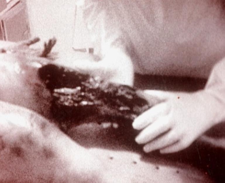 Collage of alleged Roswell alien autopsy stills.