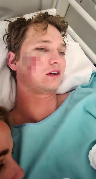 Injured man in hospital bed.