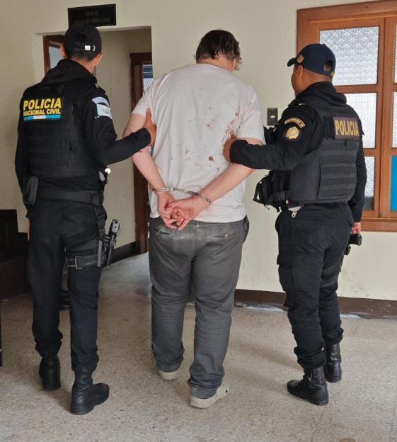 A British pensioner in handcuffs, covered in blood, is led away by two police officers in Guatemala.
