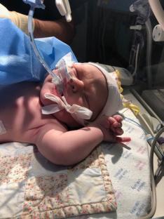 Newborn baby receiving medical treatment.