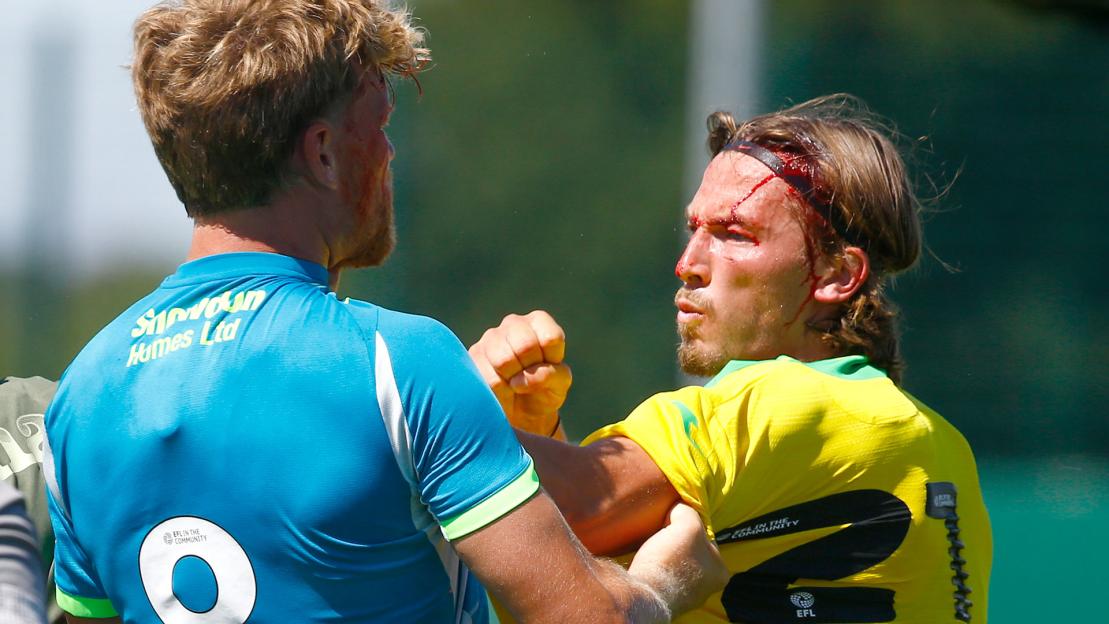 Norwich defender left with bloodied head and pulled apart from Made in Chelsea star’s husband in pre-season friendly