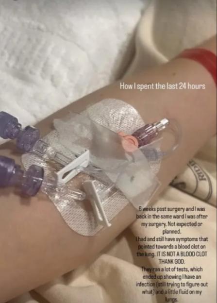 Jessie J's hospital IV drip and statement about a lung infection and fluid six weeks post-surgery.