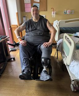 Man with prosthetic leg in a wheelchair in a hospital room.
