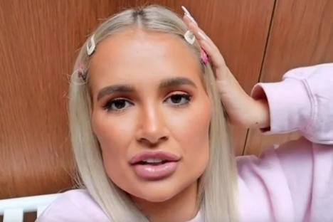 I feel sorry for myself but trolls were right – I was Quagmire & my sis saved me from destroying my face, says Molly-Mae