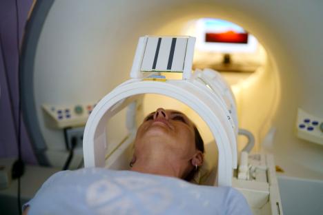 Your risk of heart attack and stroke can be detected 10 YEARS earlier with ‘simple’ scan, study shows