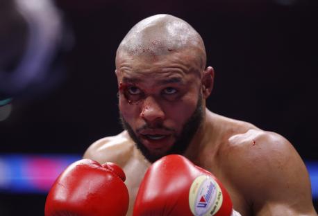 Chris Eubank Jr. with cuts and bruises during a boxing match.