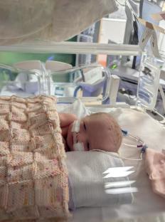 Newborn baby in an incubator.