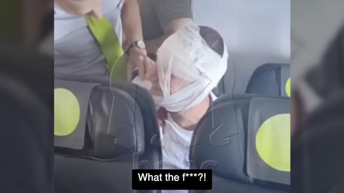 A restrained passenger on an airplane.