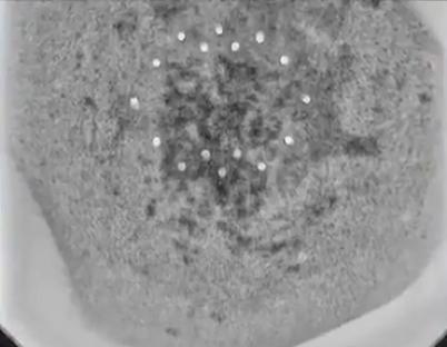 X-ray of a spherical UFO that crash-landed in Buga, Colombia.