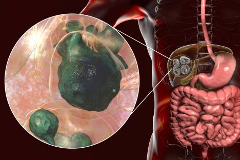 Surge in ‘neglected’ deadly parasite that destroys your organs sparks fears it will ‘inevitably’ reach the UK