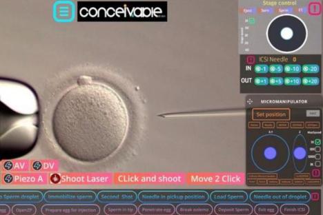 World’s first baby conceived by sperm-injecting robot is born – thanks to AI-operated machine