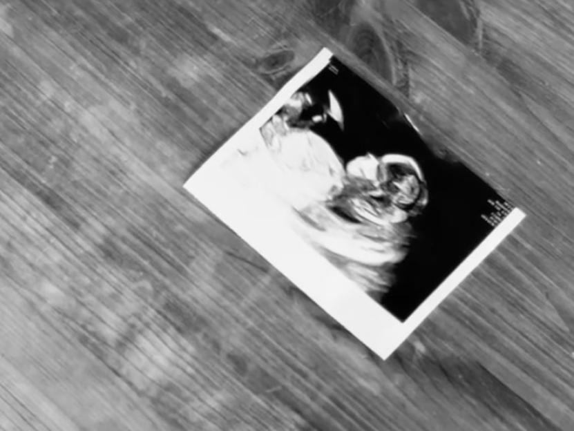 Ultrasound image on a wooden surface.