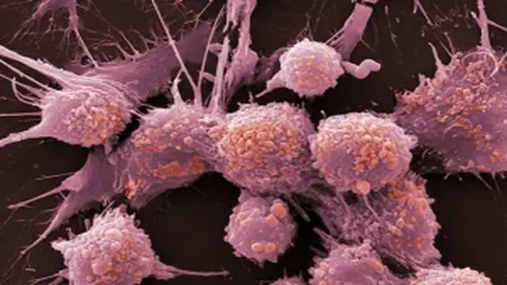 The 6 signs of prostate cancer you need to know as Dermot Murnaghan reveals diagnosis – plus who’s at greatest risk 