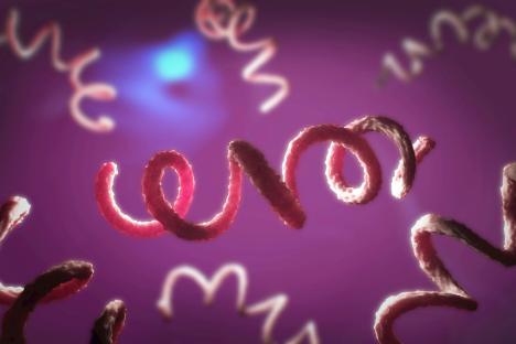 ‘Concerning’ rise of Victorian STI that can trigger heart disease, brain damage and death – are you at risk?