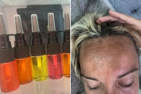 ‘Dangerous’ nasal tanning sprays linked to killer cancer – as Brits issued warning