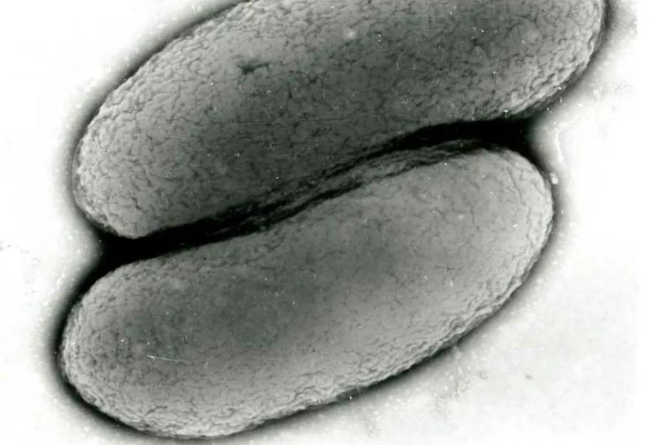 Case of bubonic plague detected in the UK as expert issues important warning over fatal infection