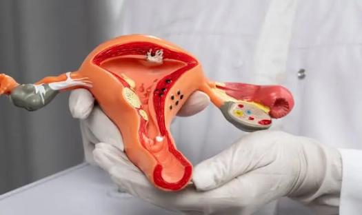 12,000 women diagnosed with cervical cancer annually – Minister